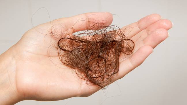 脱发人群超2.5亿 平均6个人中就有一位出现脱发的情况